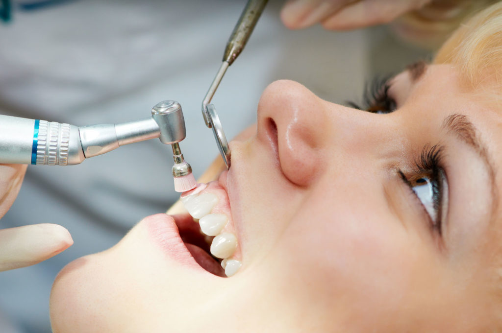 close-up medical dentist procedure of teeth polishing with cleaning from dental deposit and odontolith