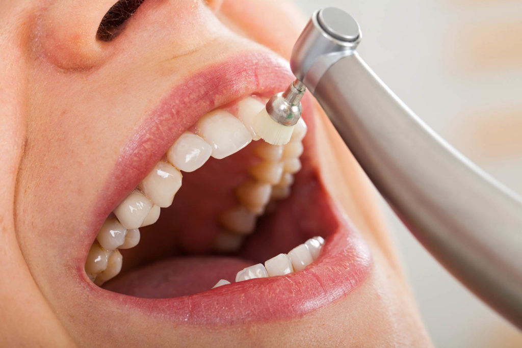 Professional dental cleaning, female patient's beautiful denture