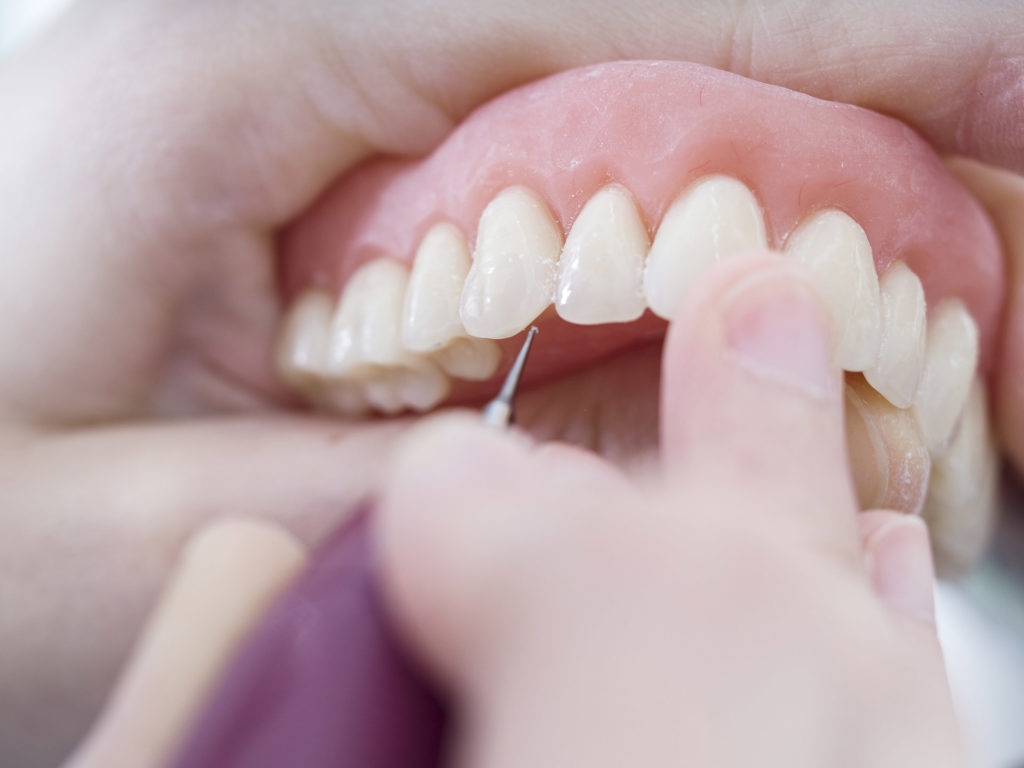 Dentist examining a patient's teeth